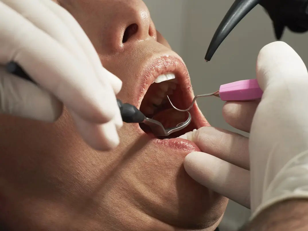 Periodoncia en Rincón de Milberg